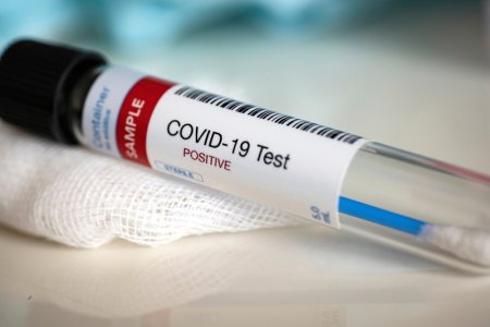 Сырдарияда 7 адамнан  коронавирус анықталды